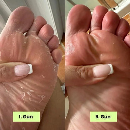 Loravey® Mantar Karşıtı Rahatlatıcı Sabun Bar